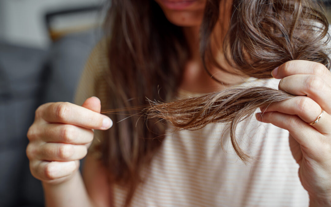 How Common is Hair Loss in Women?